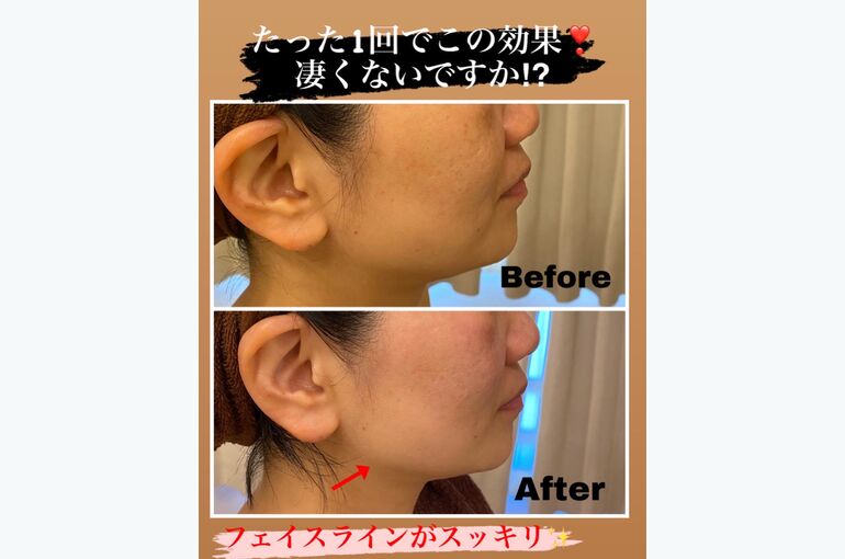 Before after