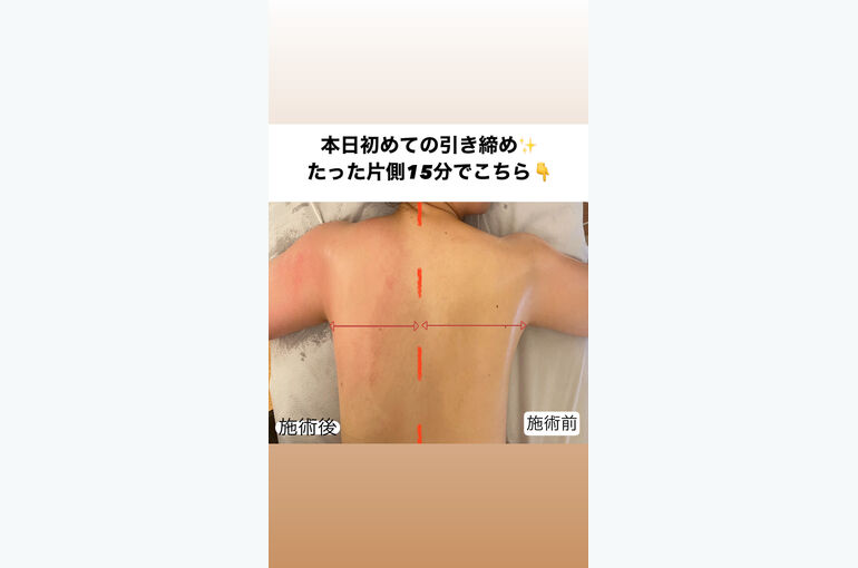ビフォーアフター