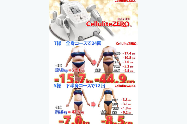 セルライトゼロ