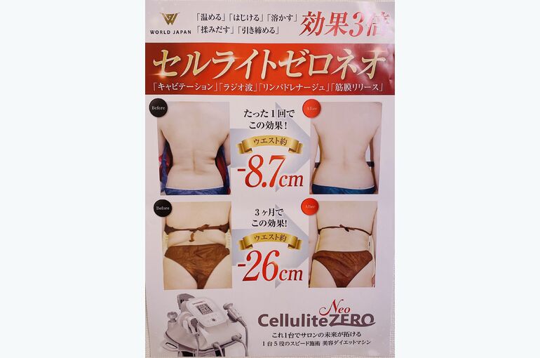セルライトゼロ