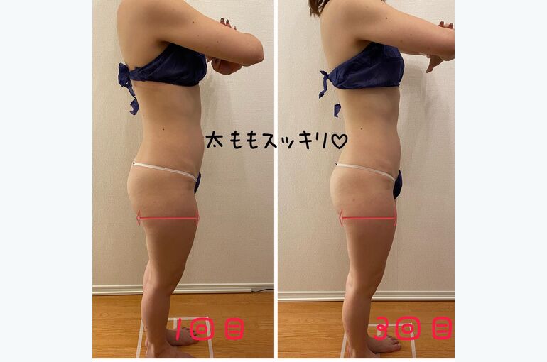 ビフォーアフター
